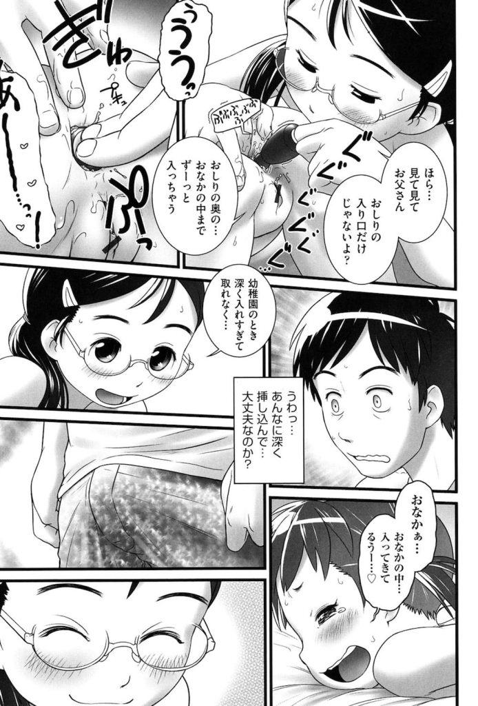 【JS開発エロ漫画】記憶喪失になった男！彼にはJSの娘が二人いた！思い出させようと二人がとった行為！アナルパール二本差しに尿道異物挿入にアナルフィスト！いつもしてたの！【おぐ】
